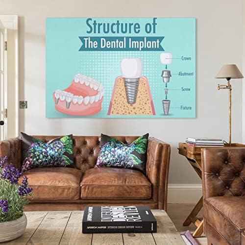 Plakati stomatološki implantat zubna skrb Poster stomatološka klinika Medicinska bolnica Znanstveni plakat platna zidni umjetnički