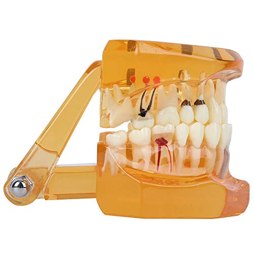 1 komad narančaste boje, uklonjivi studij podučavanje zuba Model zubno 1 komad stomatološke bolesti Zubna oralna škola Model